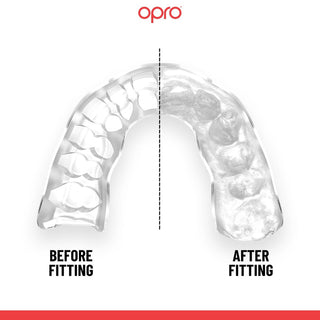 Protetor Bucal Opro Instant Custom-Fit Dentes de Ouro 